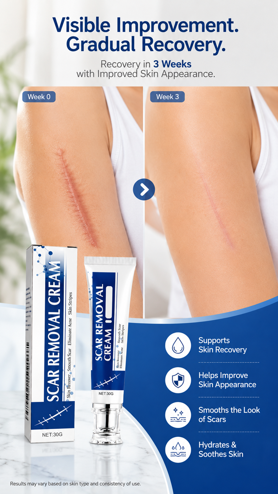 Advanced Scar Gel and Scar Removal Cream