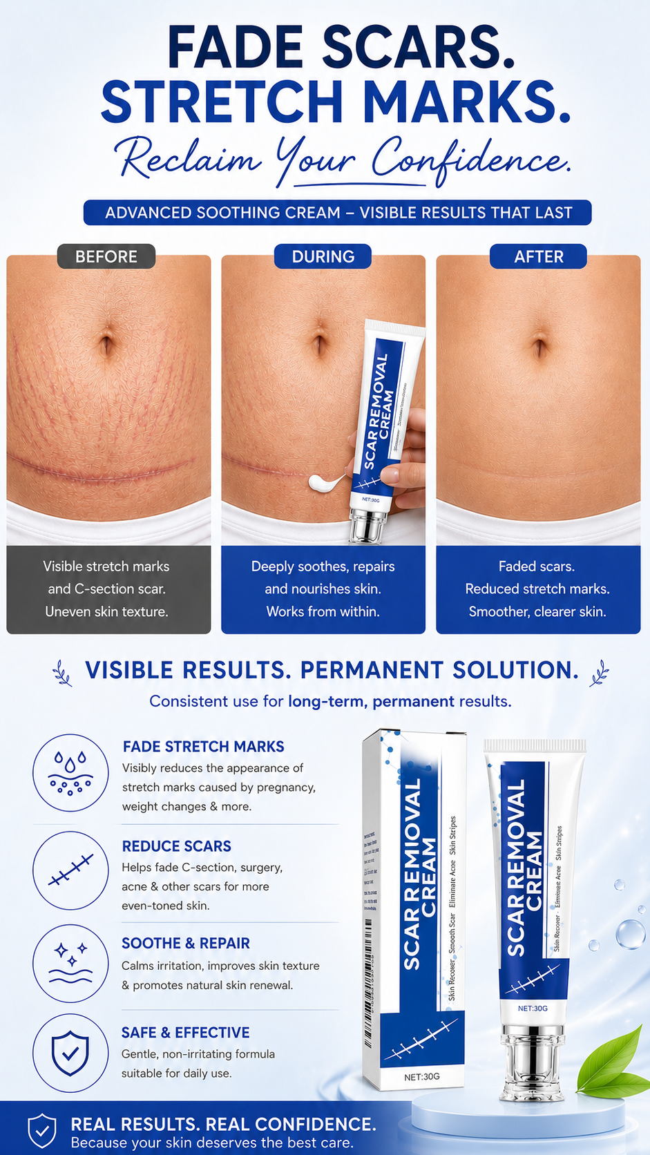 Advanced Scar Gel and Scar Removal Cream